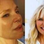 Christie Brinkley's Skin Cancer Revelation: A Tale of Resilience and Vigilance!