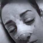 "Jacy Jayne's Shocking Surgery Snap: Nose Injury Fallout Revealed!"