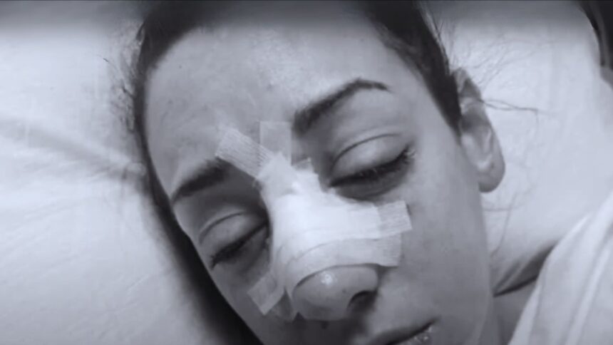 "Jacy Jayne's Shocking Surgery Snap: Nose Injury Fallout Revealed!"